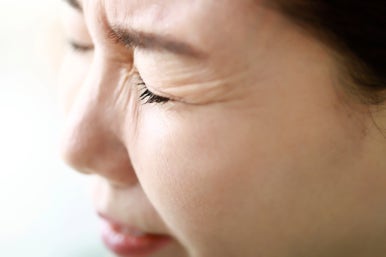 The Difference Between Lower Eye Fat Repositioning and Lower Blepharoplasty, the Snapback Test, and the Distraction Test #Gangnam Plastic Surgery Objet image 7