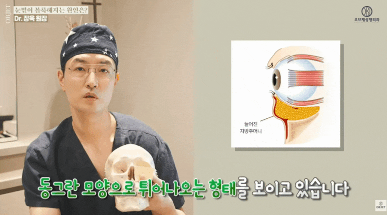 Cause of Under-Eye Fat? Read Dr. Jang Wook’s <Key Summary> First! image 7