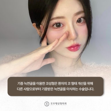 Natural Tip Rhinoplasty #Yeoksam-dong#Gangnam image 9