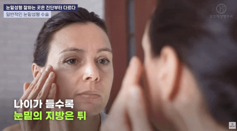 강남 눈밑지 레이저 vs 수술! 김현조 원장님의 추천은? 관련 이미지 2