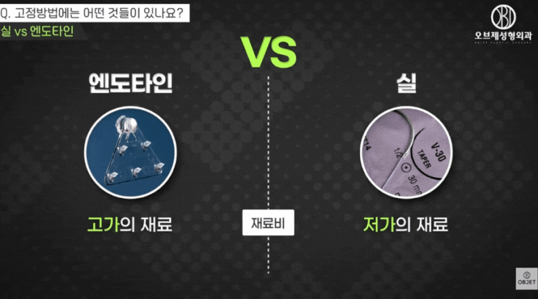 엔도타인이마거상? 신종인 원장님이 추천하는 <이유> 공개! 관련 이미지 7