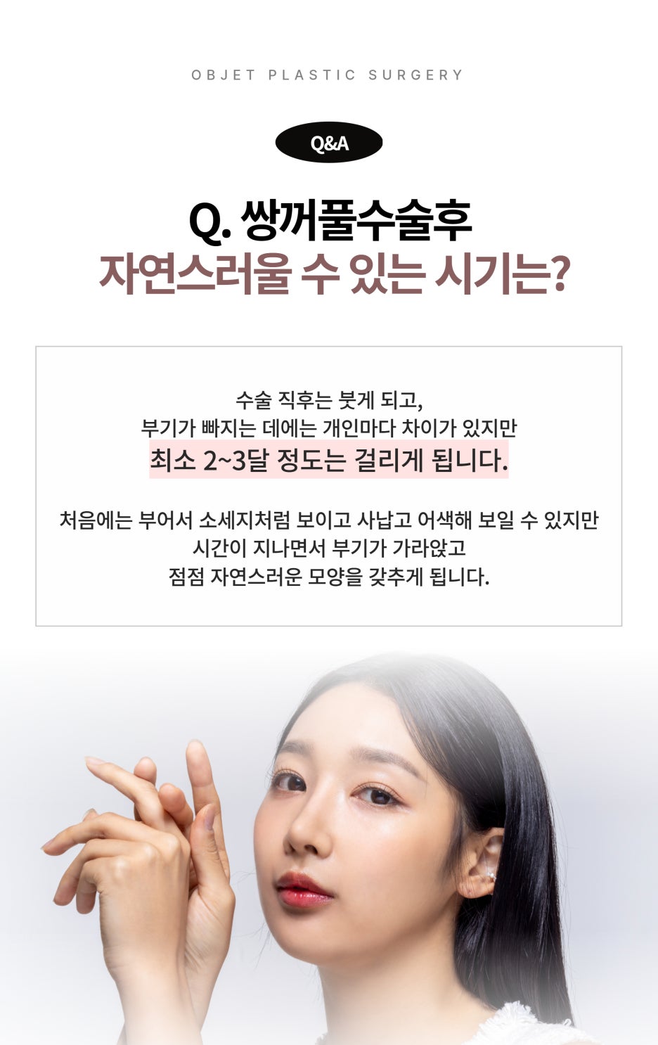 Questions About Double Eyelid Surgery in Gangnam image 2