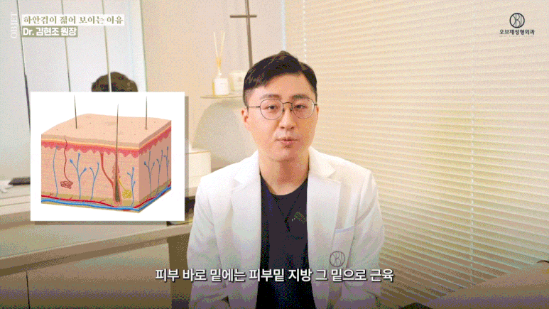 50대 하안검수술후기, 동안 효과는 여기서 갈린다고요? 관련 이미지 4