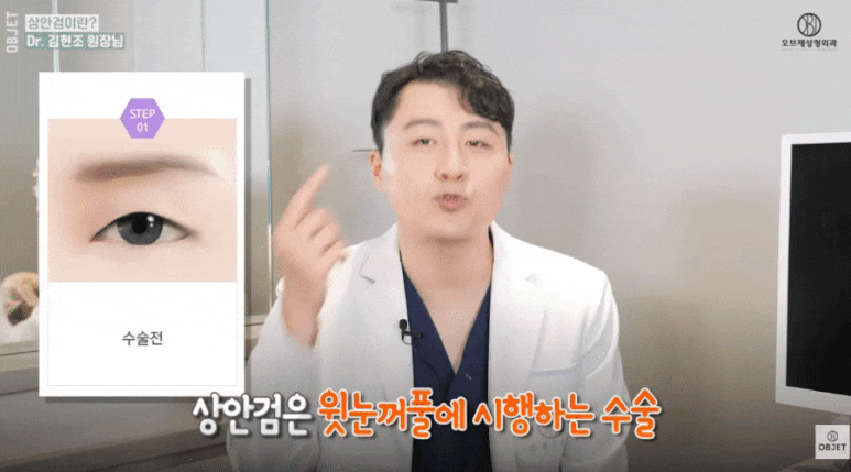 Forehead Lift Effect? For Drooping Eyelids, Director Kim Hyun-jo’s <3> Recommendations! image 2