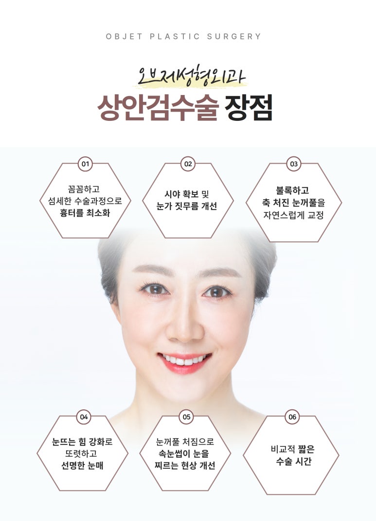 상안검수술과 눈썹하거상술 차이점 관련 이미지 5