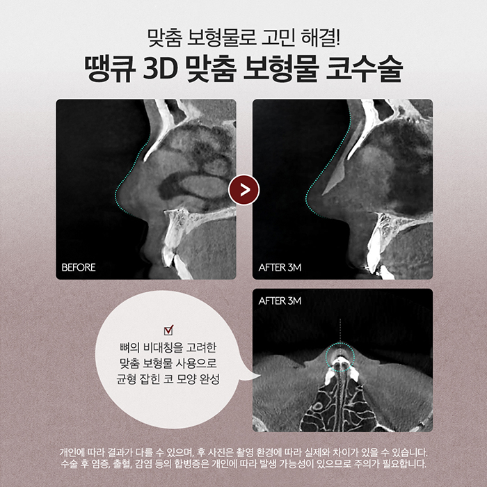 맥미걸 관련 이미지 5
