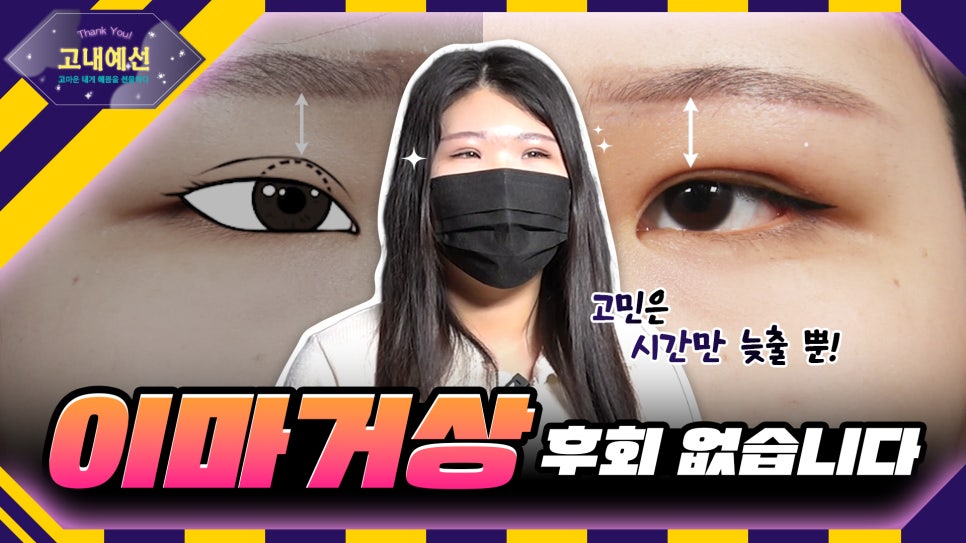 이 나이에?! 20대 이마거상술 (쌍수 후 속쌍 방지🚫) 관련 이미지 3