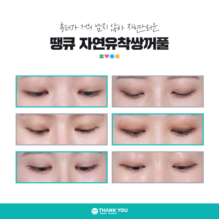 자연유착쌍커풀 수술로 타고난 듯 아름다운 눈 만들기🍀 관련 이미지 7