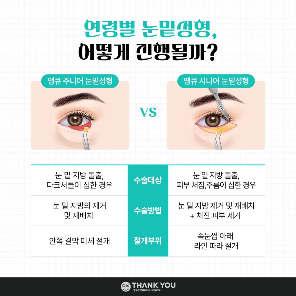 눈밑성형, 연령별로 달라지는 수술법! 무엇이 다를까? 관련 이미지 5