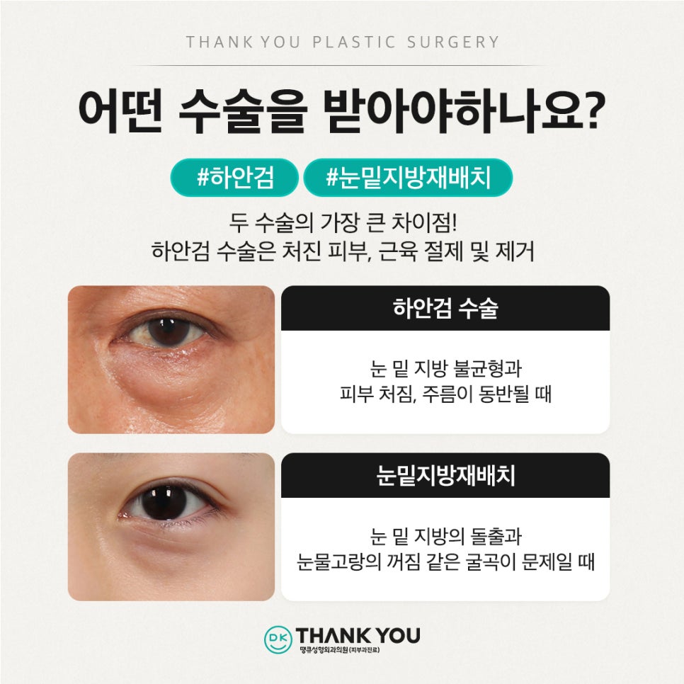 중년눈성형, 하안검수술비용 알아보기 전 이것만은 알고 가세요 관련 이미지 5