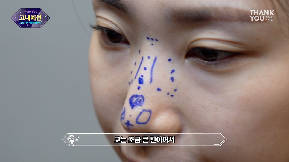 땡큐성형외과 상담부터~디자인 수술까지 (눈코 성형) 관련 이미지 8