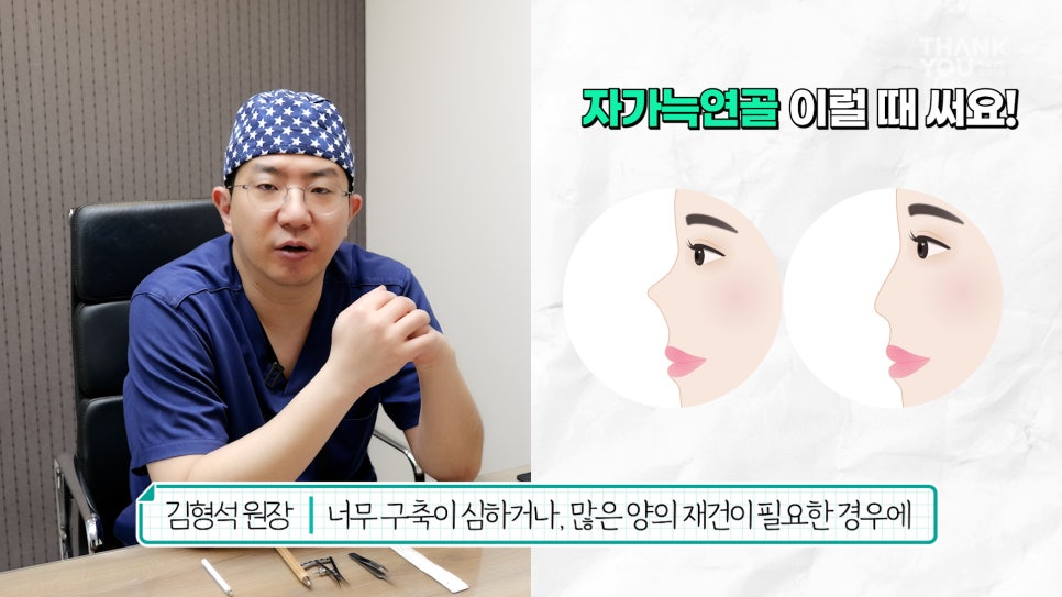 자가늑연골 코수술 장단점, 실리콘없이 무보형물 전후Check 관련 이미지 9