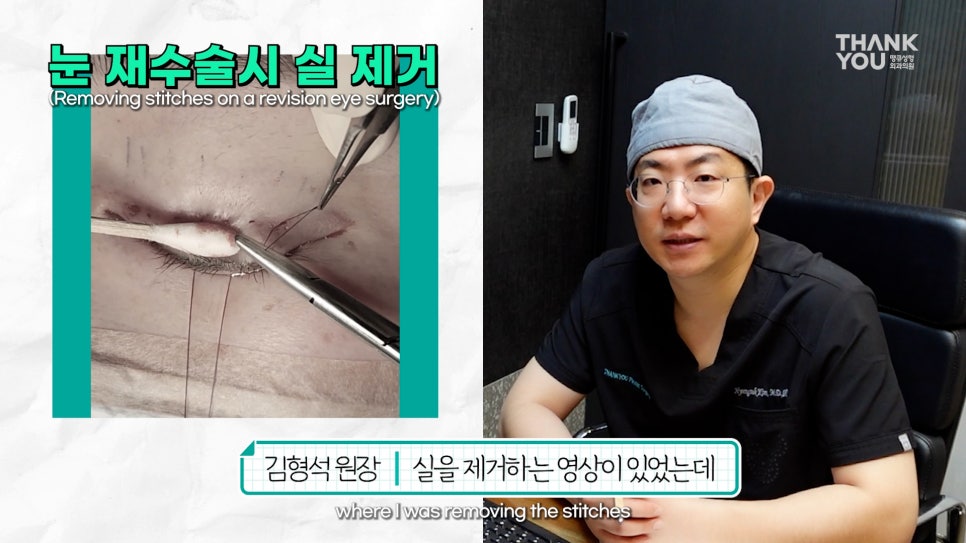 눈꺼풀에 딱딱한 여드름? 육아종 제거 [비절개] 관련 이미지 9