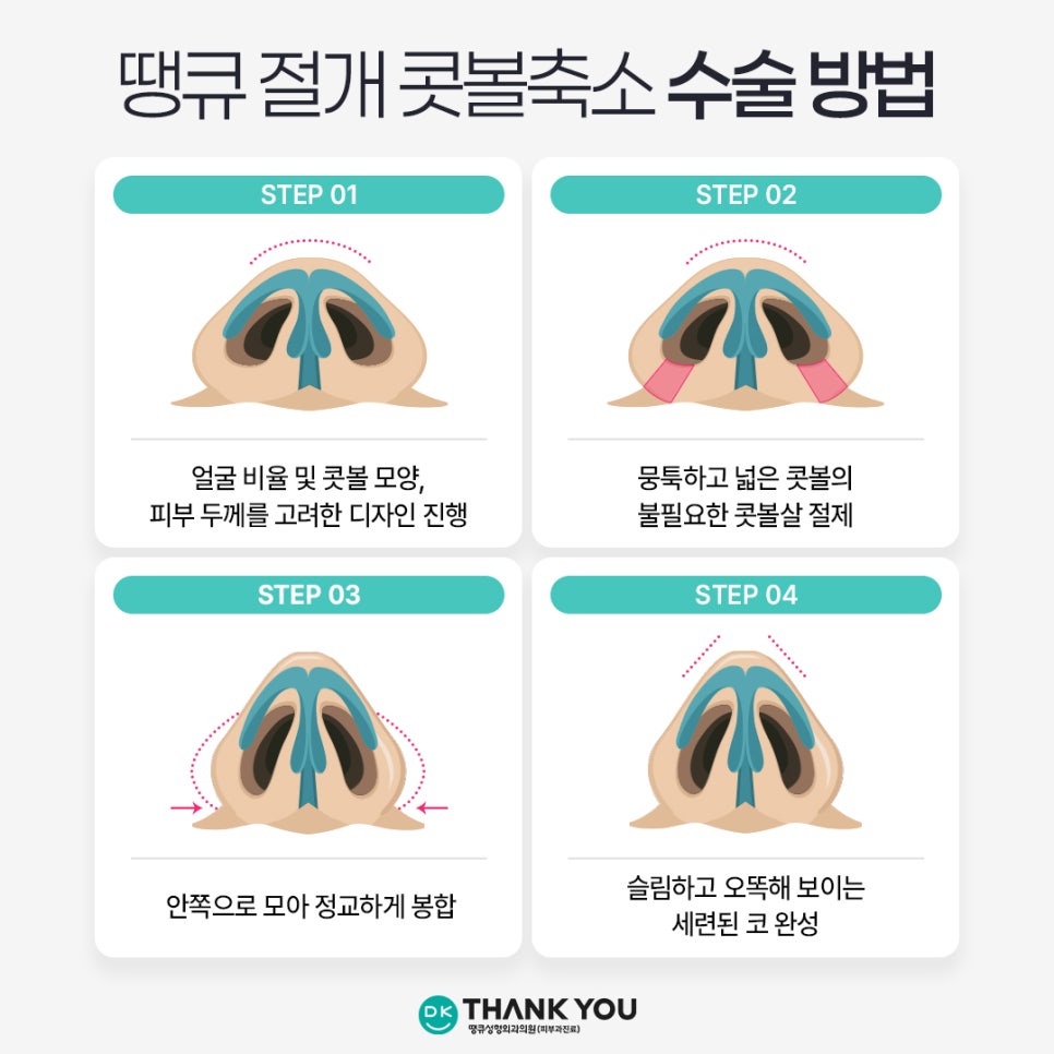콧볼성형 찾는다면 여기! 땡큐 콧볼축소로 세련된 이미지 완성하기! 관련 이미지 5
