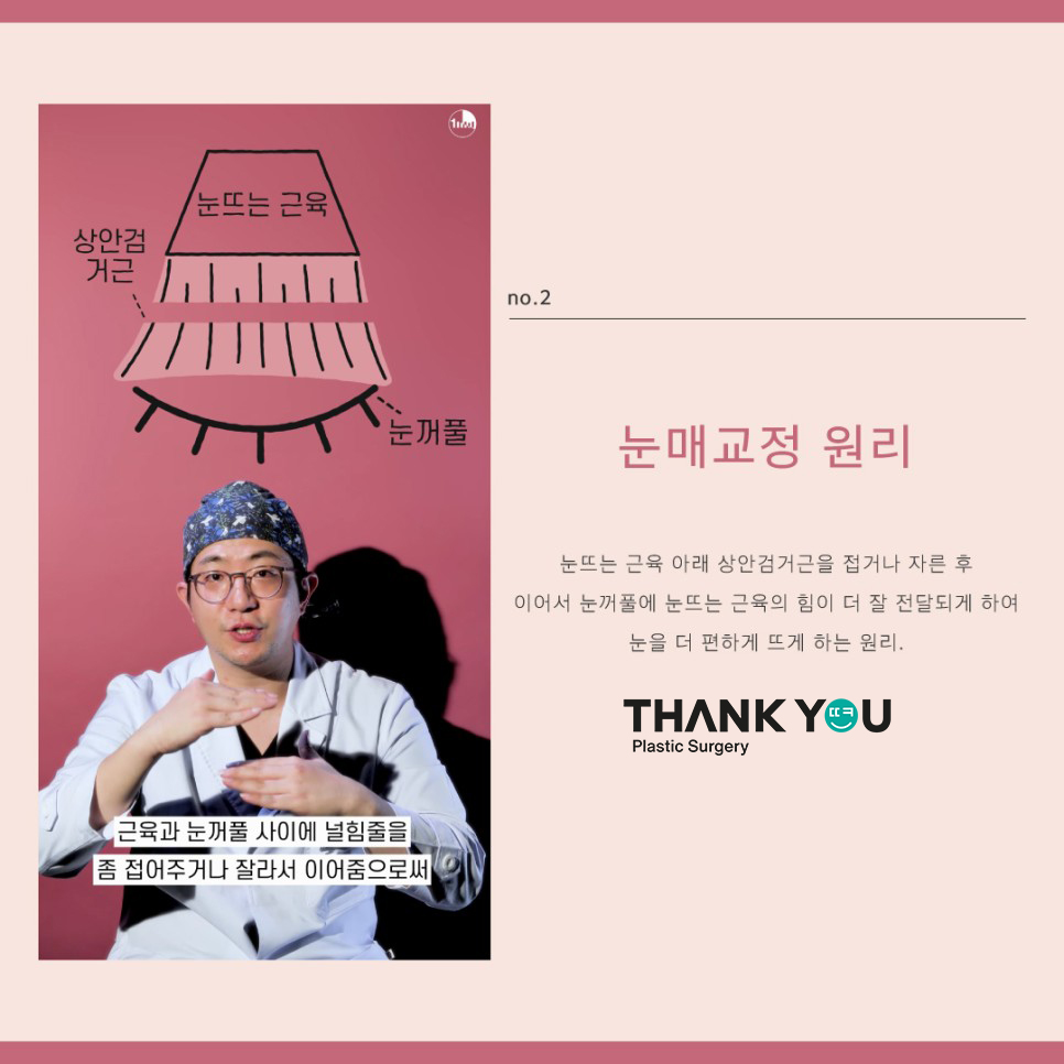 땡큐성형외과, 쌍수 눈매교정? 안검하수 유무 관련 이미지 3