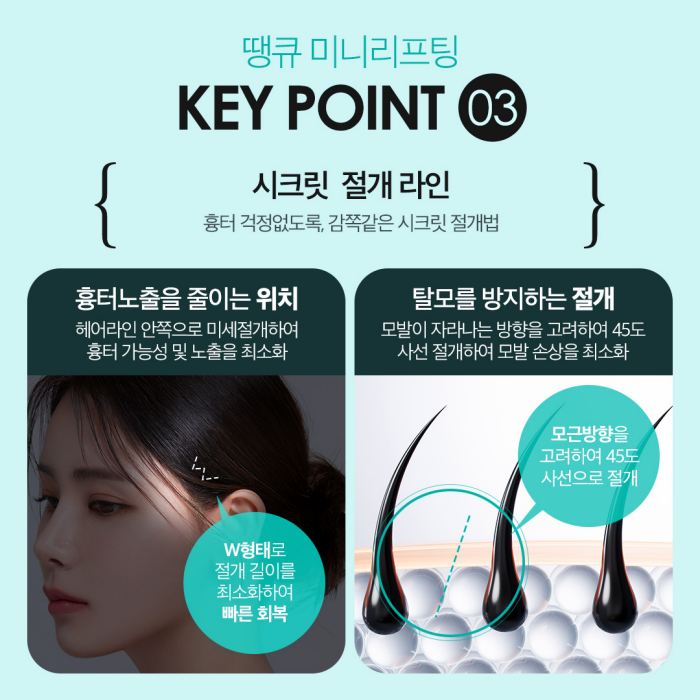 미니리프팅, 탄력과 주름을 동시에 개선하는 동안시술🤗 관련 이미지 6