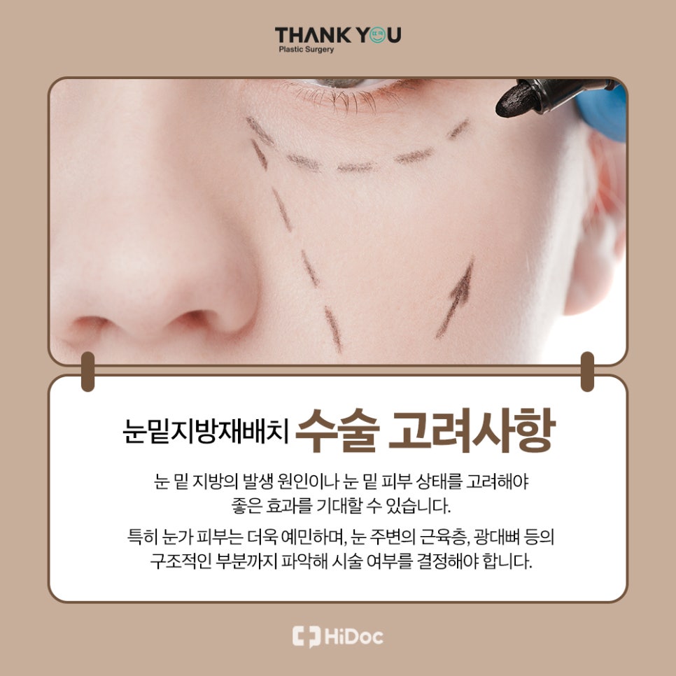 눈밑지 지방이식? 앞광대지방이식 필요한 이유? 관련 이미지 6