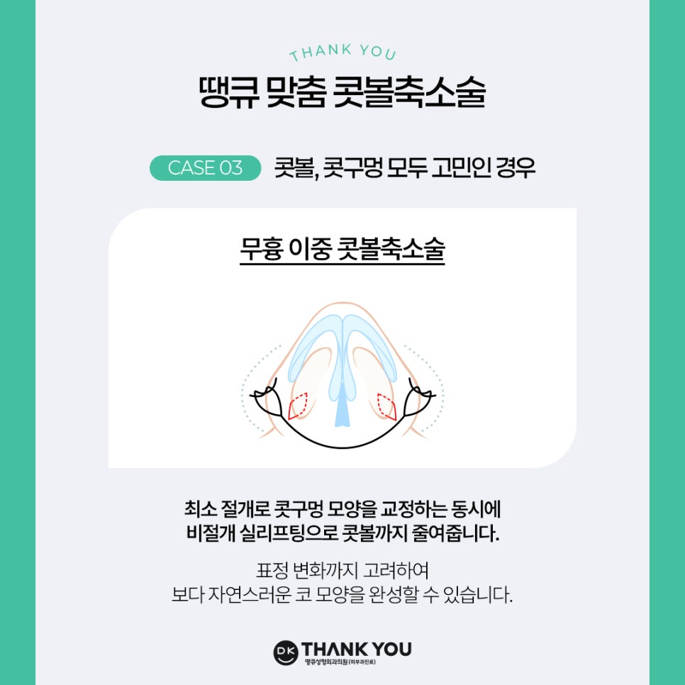 콧볼축소술, 케이스에 따른 맞춤 수술 방법은? 관련 이미지 6