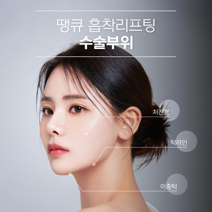 땡큐성형외과 이벤트 : 얼굴윤곽라인 개선엔?! 흡착리프팅 관련 이미지 11