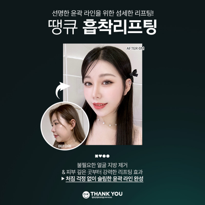 땡큐성형외과 이벤트 : 얼굴윤곽라인 개선엔?! 흡착리프팅 관련 이미지 4