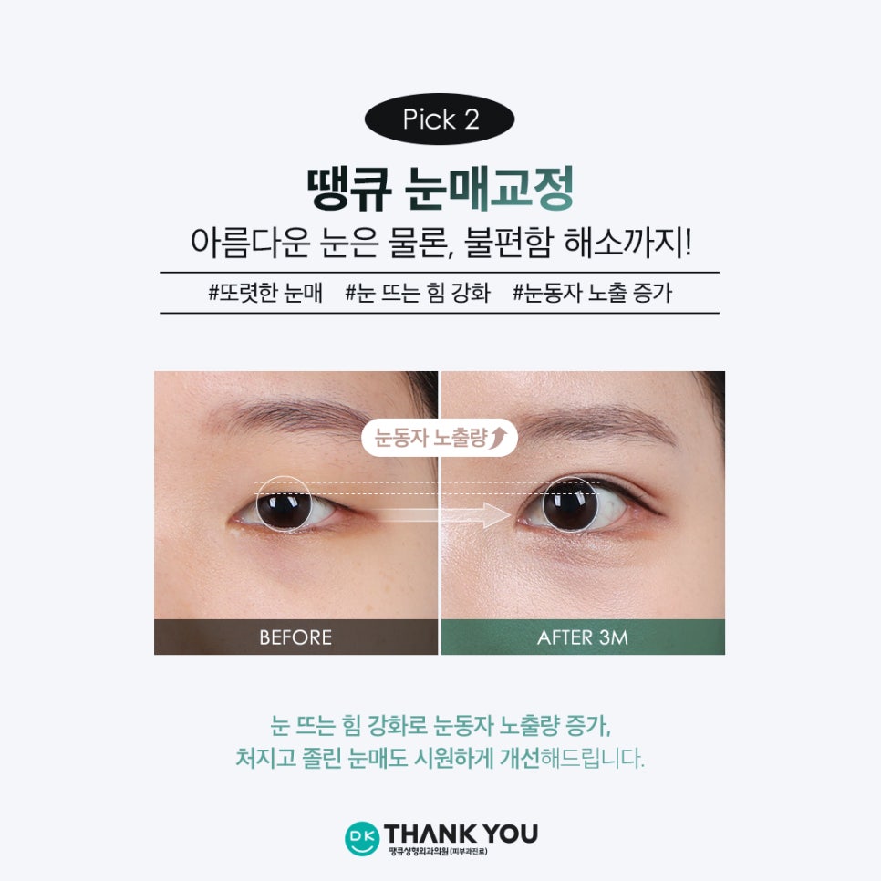 Thank You’s Exam Taker Event at a Great Place for Eye Surgery! ✨Triple Eye Surgery✨ image 5