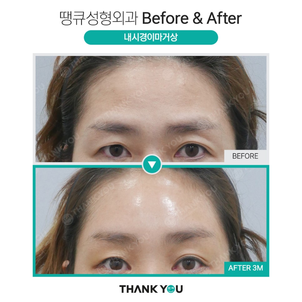 눈가 주름까지 개선하는 이마거상 관련 이미지 10