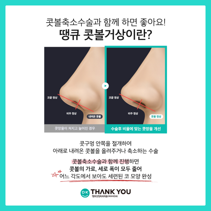 콧볼축소술효과로 세련된 이미지로의 변신 성공! 관련 이미지 7