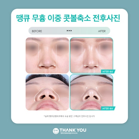 Successful Sophisticated Image Transformation with the Thank You Alar Reduction Event! image 9