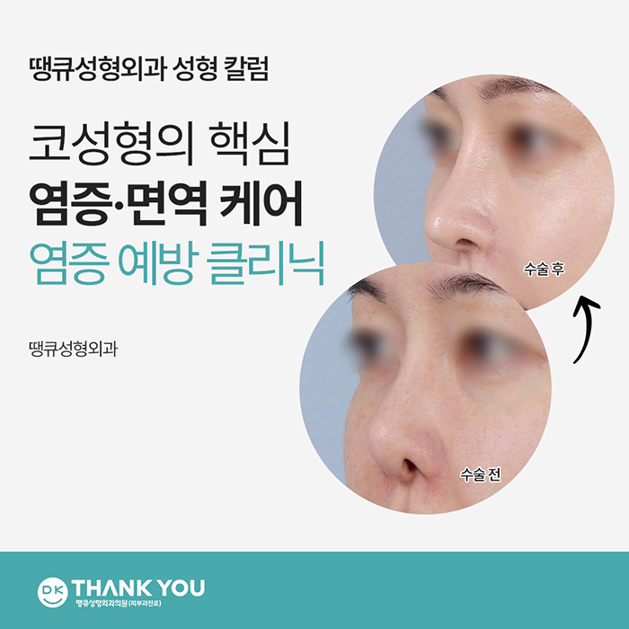 [의학정보]코성형 핵심은 관련 이미지 1