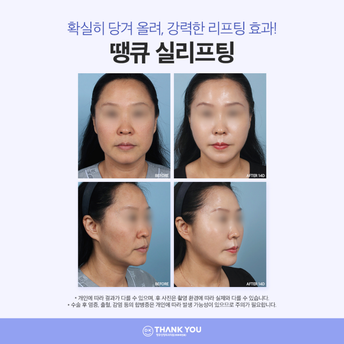 Create a Harmonious Face with Improved Face Line! Complete a Line That Suits Your Features⭐ image 5