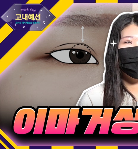 이 나이에?! 20대 이마거상술 (쌍수 후 속쌍 방지🚫) 관련 이미지 1