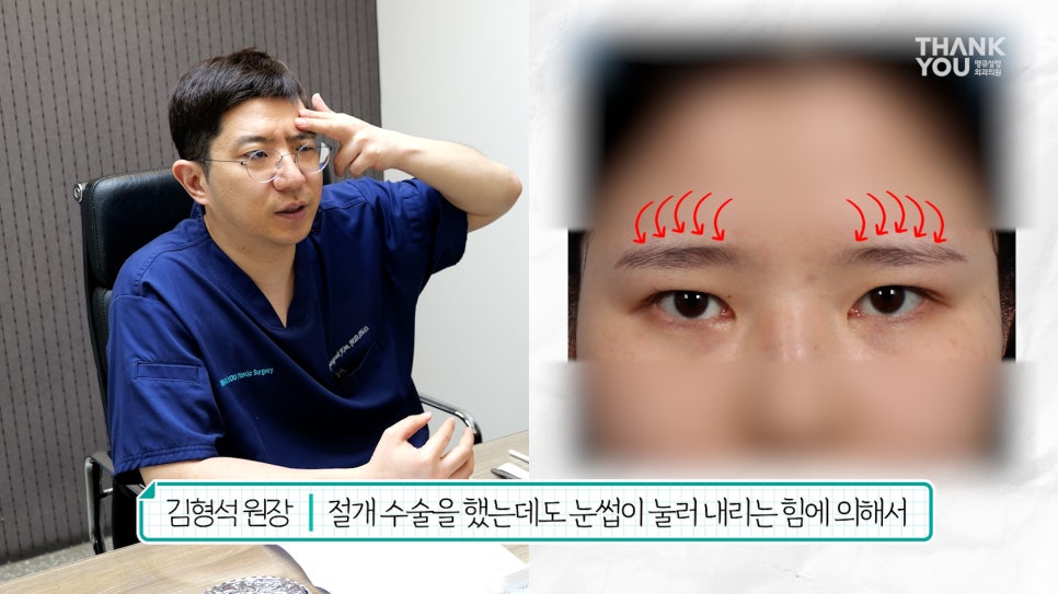 눈재수술 할 때 이마거상 추천하는 이유는? (눈썹올림술 전후) 관련 이미지 5