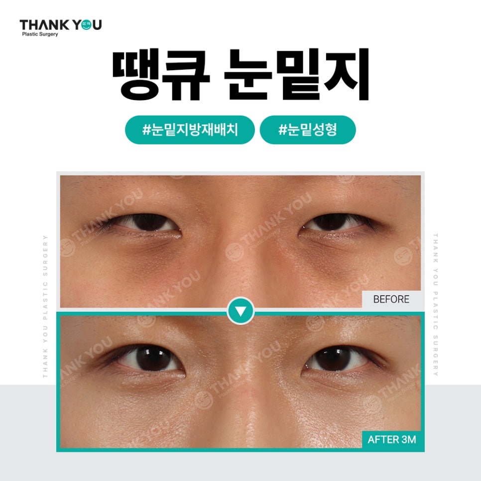 화려한 눈 가능?! 인아웃라인 김세정 쌍꺼풀처럼 관련 이미지 27