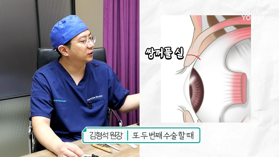 '쌍꺼풀 실 눈찌름'으로 안과? 쌍수실 제거+자연유착 라인 살리는 법 관련 이미지 8