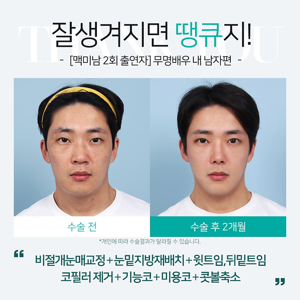 [맥미남 병원] 남자 휜코 성형, 막힌코수술, 코막힘 등 전후 까지 관련 이미지 2
