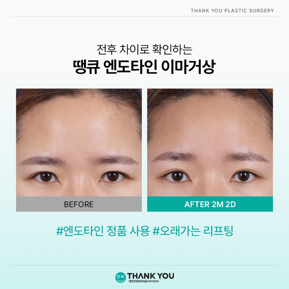 엔도타인 비용? 이마거상 시 정품 여부부터 체크!⭐️ 관련 이미지 6