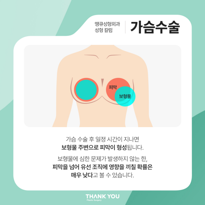 가슴수술전후 궁금증 관련 이미지 4