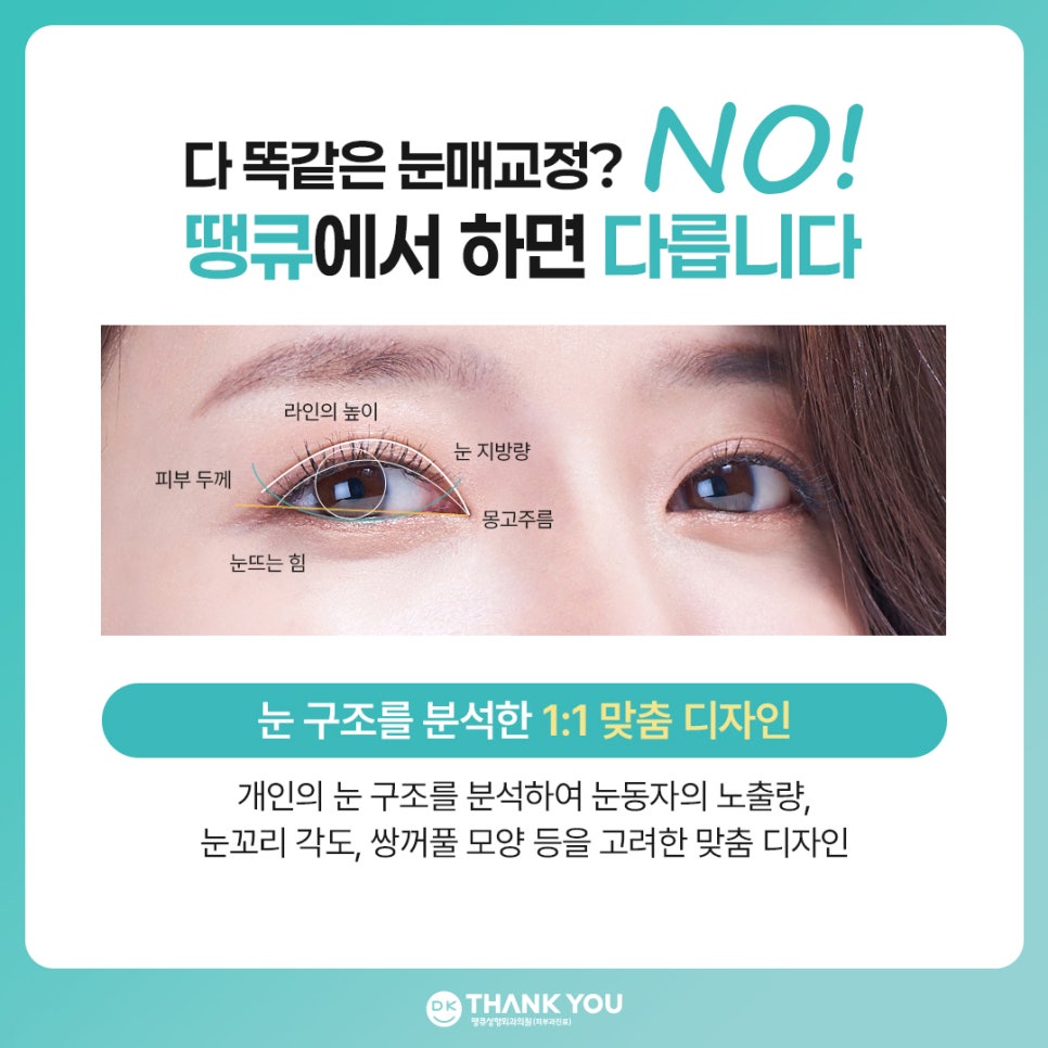 비절개 눈매교정 vs 절개 눈매교정 뭐가 다를까? 관련 이미지 9