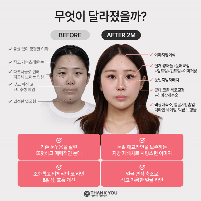 맥미걸 관련 이미지 2