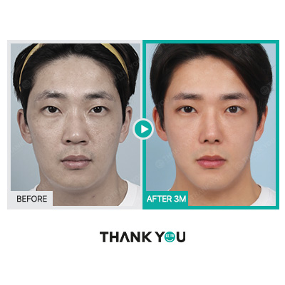 맥미남 배우, 확 달라진 변화? 남자성형외과는 THANK YOU! 관련 이미지 8