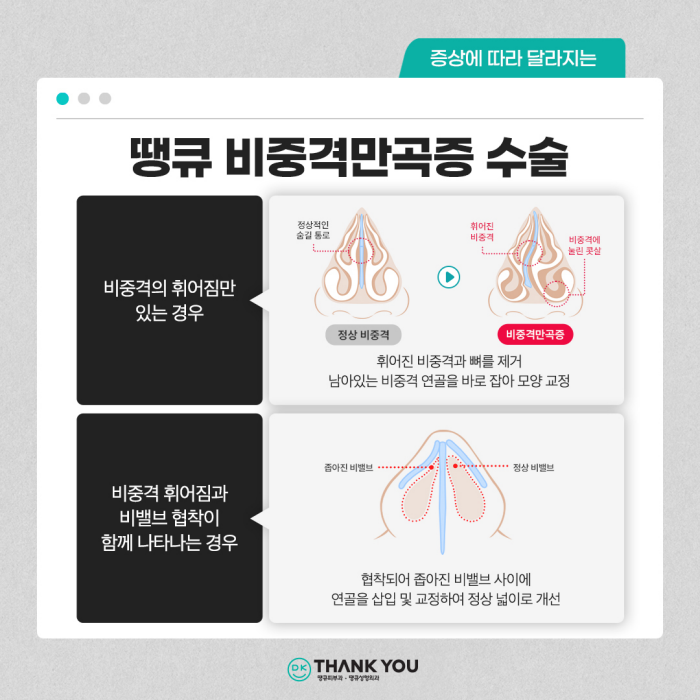 기능코수술병원에서 콧 속 불편함, 외적 스트레스 동시 해소! 관련 이미지 7