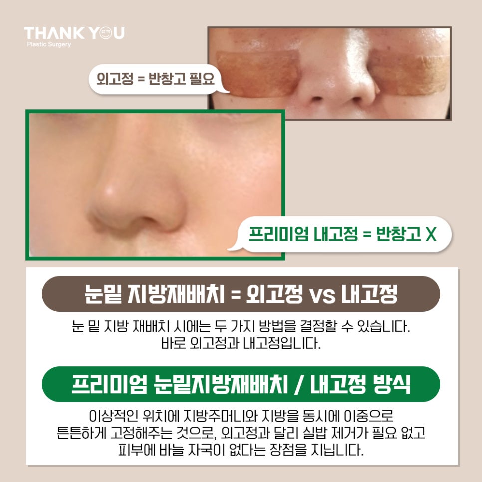 프리미엄 눈밑지방재배치(원데이)란? 땡큐 이호준 원장님 관련 이미지 9