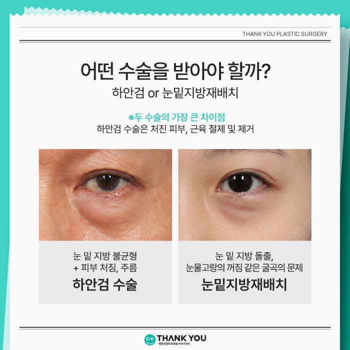 Lower Blepharoplasty and Under-Eye Fat Repositioning: What’s the Difference? image 7