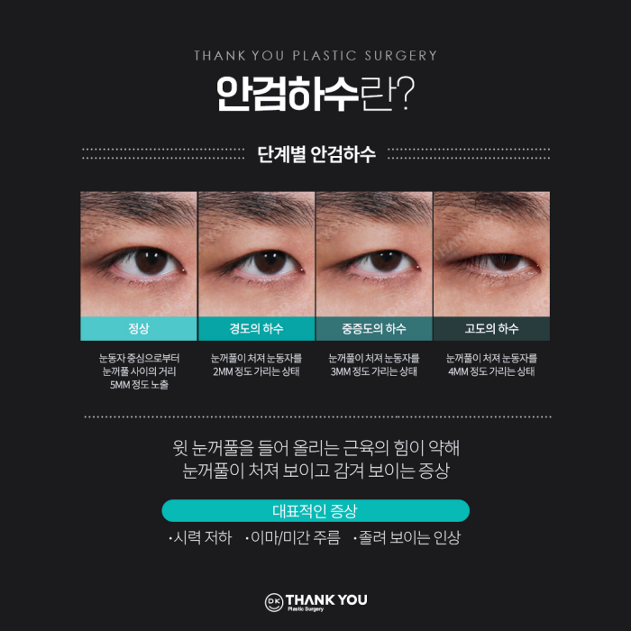 기능눈성형 근본적인 원인을 개선해야 해요! 관련 이미지 6
