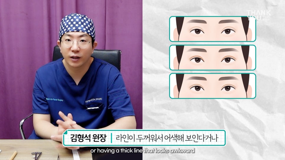 [남자 쌍수후기?] 망하기 싫으면 꼭 보세요! 관련 이미지 11