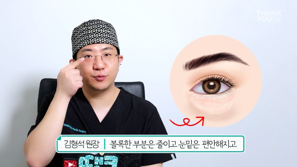 연예인 눈밑지방재배치?경결막과 눈물고랑이란? 관련 이미지 13