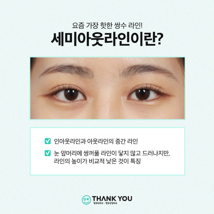 쌍수잘하는곳에서 세미아웃라인쌍꺼풀로 예쁜 눈 변신! 관련 이미지 2