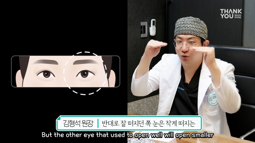 비대칭눈 교정(짝짝이 쌍꺼풀) 헤링의 법칙이란? 관련 이미지 15