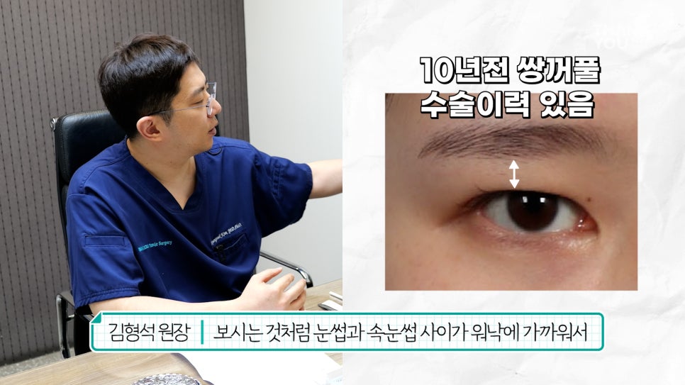 눈재수술 할 때 이마거상 추천하는 이유는? (눈썹올림술 전후) 관련 이미지 4