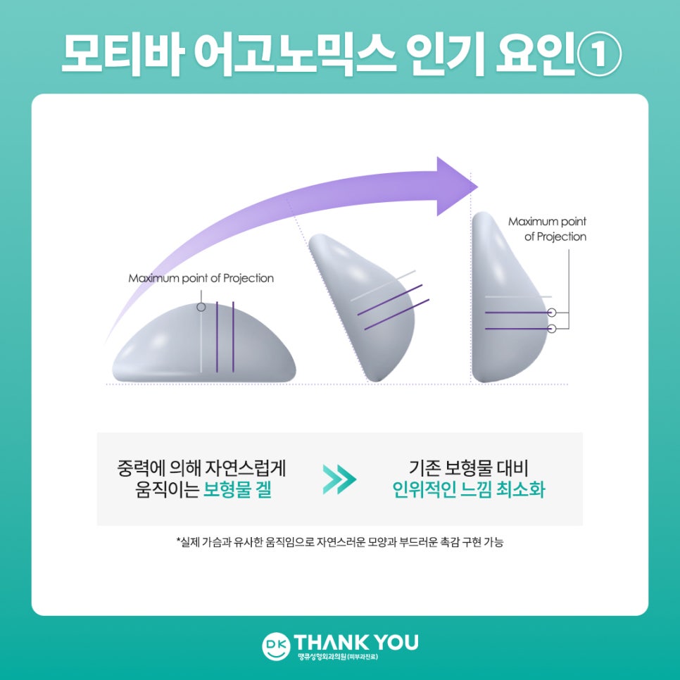 모티바가슴성형 비용만큼 궁금한, 땡큐 Before & After 관련 이미지 4